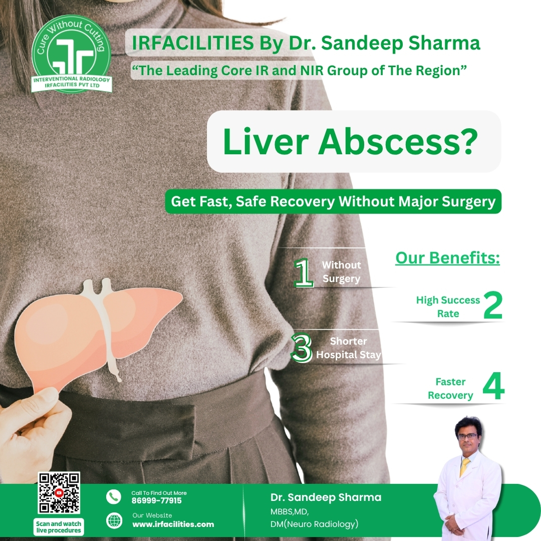 Modern Liver Abscess Drainage Treatment